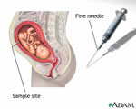 Human Genetics
