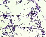 Viruses and Bacteria