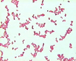 Viruses and Bacteria