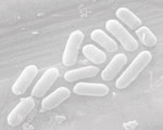 Viruses and Bacteria