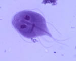 Protists and Fungi