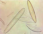Protists and Fungi