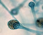 Protists and Fungi