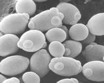Protists and Fungi