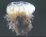 Sponges, Cnidarians and Worms