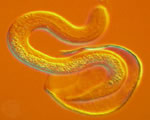 Sponges, Cnidarians and Worms