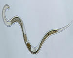 Sponges, Cnidarians and Worms