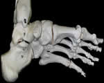 Bones, Muscles and Skin