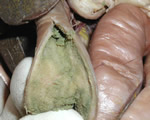 Food and Digestion