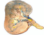 Respiration and Excretion