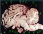 Nervous System