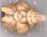 Nervous System