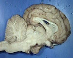 Nervous System