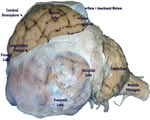 Nervous System
