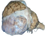 Nervous System
