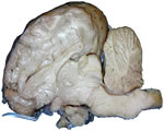 Nervous System